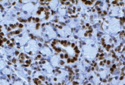 TUNEL Chromogenic Apoptosis Detection Kit A049.jpg