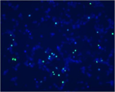 EasyProbes™ Cell Viability Imaging Kit (Blue/Green) A020.jpg