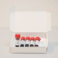 FastGene® Optima HotStart ReadyMix ls29_fastgene-optima-hotstart-ready-mix.jpg
