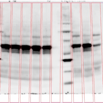 Phoretix1D – Automatic SDS PAGE and Western Blot Analysis Software Automatic-Lane-Detection.jpg