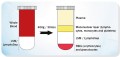 LymphoSep™, lymphocyte separation medium  