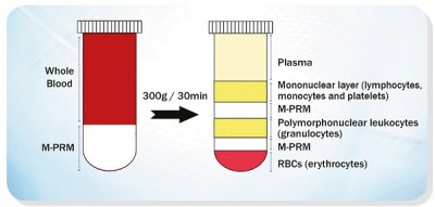 MONO-POLY™ RESOLVING MEDIUM 